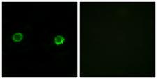 ABHD2 Antibody - Peptide - + Immunofluorescence analysis of MCF-7 cells, using ABHD2 antibody.