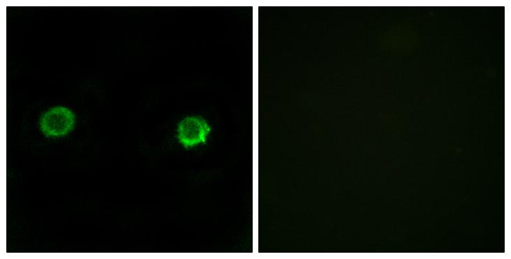 ABHD2 Antibody - Peptide - + Immunofluorescence analysis of MCF-7 cells, using ABHD2 antibody.