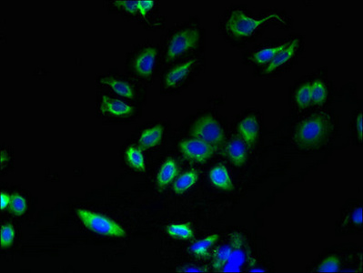 ABHD3 Antibody - Immunofluorescent analysis of HepG2 cells using ABHD3 Antibody at dilution of 1:100 and Alexa Fluor 488-congugated AffiniPure Goat Anti-Rabbit IgG(H+L)
