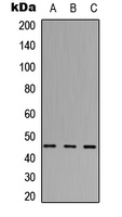 ABHD3 Antibody - Western blot analysis of ABHD3 expression in HEK293T (A); Raw264.7 (B); PC12 (C) whole cell lysates.