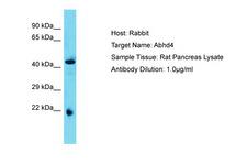 ABHD4 Antibody -  This image was taken for the unconjugated form of this product. Other forms have not been tested.