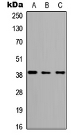 ABHD4 Antibody - Western blot analysis of ABHD4 expression in HEK293T (A); Raw264.7 (B); H9C2 (C) whole cell lysates.