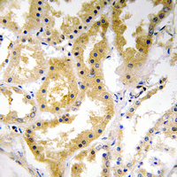 ABHD4 Antibody - Immunohistochemical analysis of ABHD4 staining in human kidney formalin fixed paraffin embedded tissue section. The section was pre-treated using heat mediated antigen retrieval with sodium citrate buffer (pH 6.0). The section was then incubated with the antibody at room temperature and detected using an HRP conjugated compact polymer system. DAB was used as the chromogen. The section was then counterstained with hematoxylin and mounted with DPX. w