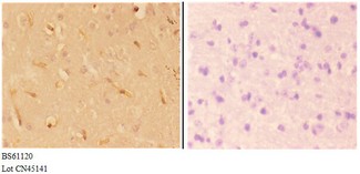 ABHD4 Antibody - Immunohistochemistry (IHC) analysis of ABHD4 antibody in paraffin-embedded mouse brain carcinoma tissue at 1:50, showing cytoplasmic and membrane staining. Negative control (the right) using PBS instead of primary antibody. Secondary antibody is Goat Anti-Rabbit.