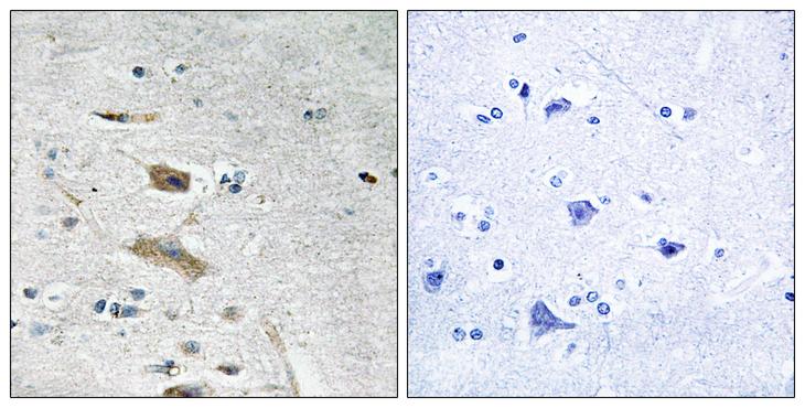 ABHD4 Antibody - Peptide - + Immunohistochemistry analysis of paraffin-embedded human brain tissue using ABHD4 antibody.