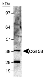 ABHD5 Antibody - Detection of CGI58 in human skeletal lysate.  This image was taken for the unconjugated form of this product. Other forms have not been tested.