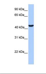 ABHD5 Antibody - MCF7 cell lysate. Antibody concentration: 1.0 ug/ml. Gel concentration: 12%.  This image was taken for the unconjugated form of this product. Other forms have not been tested.