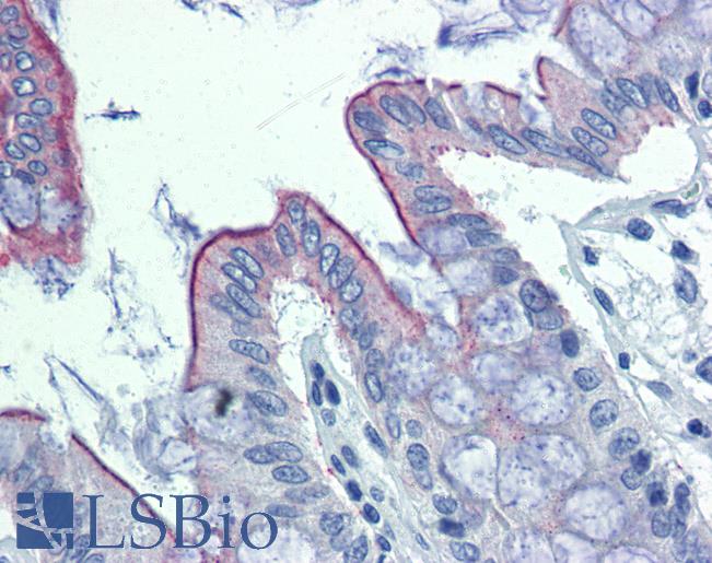 ABHD5 Antibody - Anti-ABHD5 / CGI-58 antibody IHC of human colon. Immunohistochemistry of formalin-fixed, paraffin-embedded tissue after heat-induced antigen retrieval. Antibody concentration 10 ug/ml.  This image was taken for the unconjugated form of this product. Other forms have not been tested.