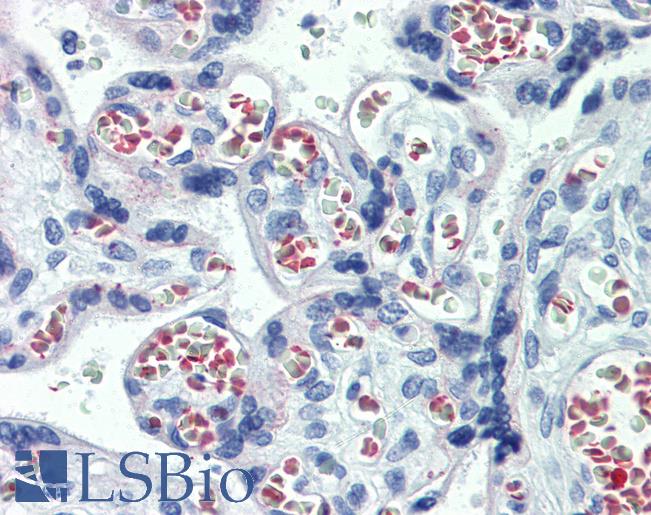 ABHD5 Antibody - Anti-ABHD5 / CGI-58 antibody IHC of human placenta. Immunohistochemistry of formalin-fixed, paraffin-embedded tissue after heat-induced antigen retrieval. Antibody concentration 10 ug/ml.  This image was taken for the unconjugated form of this product. Other forms have not been tested.