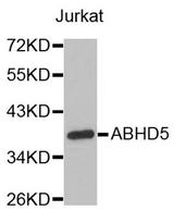ABHD5 Antibody - Western blot analysis of extracts of Jurkat cell line, using ABHD5 antibody.