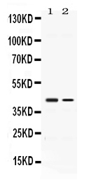 ABHD5 Antibody - Western blot - Anti-Abhd5 Picoband Antibody