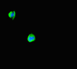 ABHD5 Antibody - Immunofluorescent analysis of MCF7 cells diluted at 1:100 and Alexa Fluor 488-congugated AffiniPure Goat Anti-Rabbit IgG(H+L)