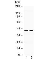 ABHD5 Antibody - Western blot testing of 1) rat kidney and 2) human A431 lysate with ABHD5 antibody at 0.5ug/ml. Predicted molecular weight ~39 kDa.