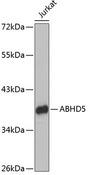 ABHD5 Antibody - Western blot analysis of extracts of Jurkat cells using ABHD5 Polyclonal Antibody.