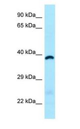 ABHD6 Antibody - ABHD6 antibody Western Blot of Fetal Heart.  This image was taken for the unconjugated form of this product. Other forms have not been tested.
