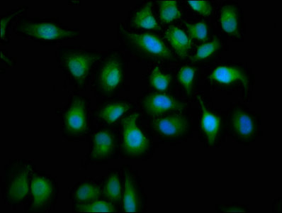 ABHD6 Antibody - Immunofluorescence staining of A549 cells with ABHD6 Antibody at 1:133, counter-stained with DAPI. The cells were fixed in 4% formaldehyde, permeabilized using 0.2% Triton X-100 and blocked in 10% normal Goat Serum. The cells were then incubated with the antibody overnight at 4°C. The secondary antibody was Alexa Fluor 488-congugated AffiniPure Goat Anti-Rabbit IgG(H+L).