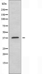 ABHD6 Antibody - Western blot analysis of extracts of COLO cells using ABHD6 antibody.