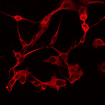 ABHD6 Antibody - Staining COLO205 cells by IF/ICC. The samples were fixed with PFA and permeabilized in 0.1% Triton X-100, then blocked in 10% serum for 45 min at 25°C. The primary antibody was diluted at 1:200 and incubated with the sample for 1 hour at 37°C. An Alexa Fluor 594 conjugated goat anti-rabbit IgG (H+L) Ab, diluted at 1/600, was used as the secondary antibody.