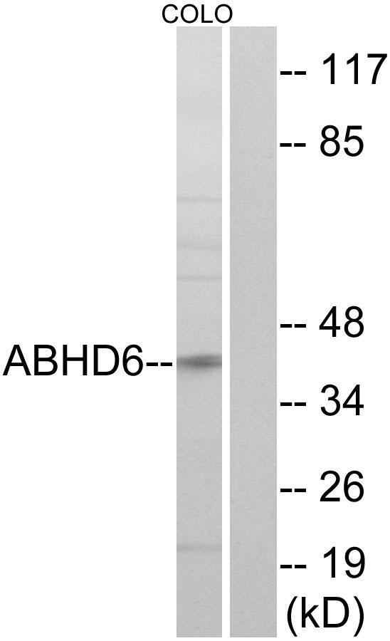 ABHD6 Antibody - Western blot analysis of extracts from COLO cells, using ABHD6 antibody.