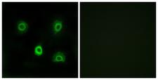 ABHD6 Antibody - Peptide - + Immunofluorescence analysis of A549 cells, using ABHD6 antibody.