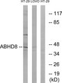 ABHD8 Antibody - Western blot analysis of lysates from HT-29 and LOVO cells, using ABHD8 Antibody. The lane on the right is blocked with the synthesized peptide.