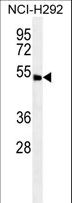ABHD8 Antibody - ABHD8 Antibody western blot of NCI-H292 cell line lysates (35 ug/lane). The ABHD8 antibody detected the ABHD8 protein (arrow).