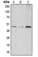 ABHD8 Antibody - Western blot analysis of ABHD8 expression in HepG2 (A); mouse kidney (B); rat kidney (C) whole cell lysates.