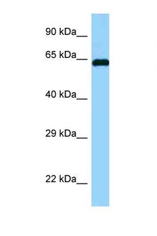 ABI1 / SSH3BP1 Antibody - ABI1 antibody Western blot of Fetal Brain lysate. Antibody concentration 1 ug/ml.  This image was taken for the unconjugated form of this product. Other forms have not been tested.