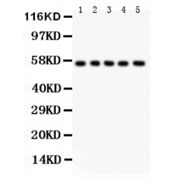 ABI1 / SSH3BP1 Antibody - SSH3BP1 antibody Western blot. All lanes: Anti SSH3BP1 at 0.5 ug/ml. Lane 1: Rat Liver Tissue Lysate at 50 ug. Lane 2: Rat Testis Tissue Lysate at 50 ug. Lane 3: HELA Whole Cell Lysate at 40 ug. Lane 4: RH35 Whole Cell Lysate at 40 ug. Lane 5: HEPA Whole Cell Lysate at 40 ug. Predicted band size: 55 kD. Observed band size: 55 kD.