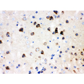 ABI1 / SSH3BP1 Antibody - SSH3BP1 antibody IHC-paraffin. IHC(P): Mouse Brain Tissue.