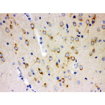 ABI1 / SSH3BP1 Antibody - SSH3BP1 antibody IHC-paraffin. IHC(P): Rat Brain Tissue.