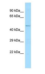 ABI1 / SSH3BP1 Antibody - ABI1 / ABI-1 antibody Western Blot of Rat Brain.  This image was taken for the unconjugated form of this product. Other forms have not been tested.