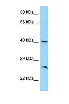 ABI1 / SSH3BP1 Antibody - ABI1 antibody Western blot of 721_B Cell lysate. Antibody concentration 1 ug/ml.  This image was taken for the unconjugated form of this product. Other forms have not been tested.