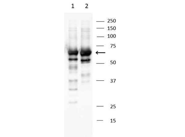 ABI1 / SSH3BP1 Antibody - Western Blot of rabbit anti-Abi1 antibody. Marker: BioRad Precision Plus Dual Color Standard. Lane 1: Purified recombinant His-tagged Abi1 Isoform 2. Lane 2: Purified recombinant His-tagged Abi1 Isoform 3. Load: 2 µL per lane. Primary antibody: Abi1 antibody at 1:1,000 for 2hrs at RT. Secondary antibody: HRP conjugated goat-a-rabbit at 1:10,000 for 60 min at RT. Blocking Buffer: 5% non-fat milk in TBS-t overnight at 4°C. Predicted/Observed size: 65 kDa for Abi1.