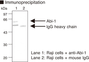 ABI1 / SSH3BP1 Antibody