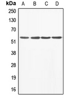 ABI1 / SSH3BP1 Antibody - Western blot analysis of ABI1 expression in A549 (A); MCF7 (B); mouse liver (C); rat heart (D) whole cell lysates.