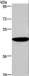ABI1 / SSH3BP1 Antibody - Western blot analysis of Human fetal brain tissue, using ABI1 Polyclonal Antibody at dilution of 1:300.