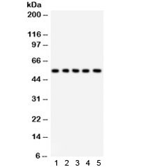 ABI1 / SSH3BP1 Antibody