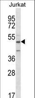 ABI2B / ABI2 Antibody - ABI2 Antibody western blot of Jurkat cell line lysates (35 ug/lane). The ABI2 antibody detected the ABI2 protein (arrow).