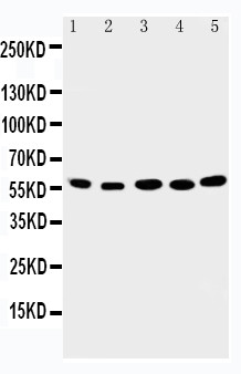 ABI2B / ABI2 Antibody - WB of ABI2B / ABI2 antibody. Lane 1: Rat Brain Tissue Lysate. Lane 2: Human Placenta Tissue Lysate. Lane 3: MCF-7 Cell Lysate. Lane 4: HELA Cell Lysate. Lane 5: JURKAT Cell Lysate.