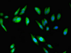 ABI2B / ABI2 Antibody - Immunofluorescent analysis of Hela cells a at a dilution of 1:100 and Alexa Fluor 488-congugated AffiniPure Goat Anti-Rabbit IgG(H+L)