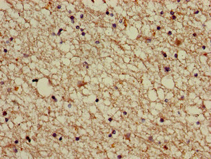 ABI2B / ABI2 Antibody - Immunohistochemistry image of paraffin-embedded human brain tissue at a dilution of 1:100