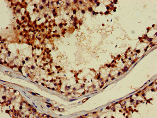 ABI2B / ABI2 Antibody - Immunohistochemistry image of paraffin-embedded human testis tissue at a dilution of 1:100