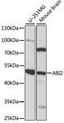 ABI2B / ABI2 Antibody - Western blot analysis of extracts of various cell lines, using ABI2 antibody at 1:1000 dilution. The secondary antibody used was an HRP Goat Anti-Rabbit IgG (H+L) at 1:10000 dilution. Lysates were loaded 25ug per lane and 3% nonfat dry milk in TBST was used for blocking. An ECL Kit was used for detection and the exposure time was 90s.