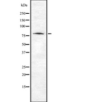 ABI2B / ABI2 Antibody - Western blot analysis of ABI2 using 293 whole cells lysates