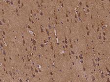 ABI2B / ABI2 Antibody - Immunochemical staining of human ABI2 in human brain with rabbit polyclonal antibody at 1:100 dilution, formalin-fixed paraffin embedded sections.
