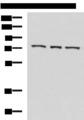ABI2B / ABI2 Antibody - Western blot analysis of K562 cell Mouse heart tissue Jurkat cell lysates  using ABI2 Polyclonal Antibody at dilution of 1:550