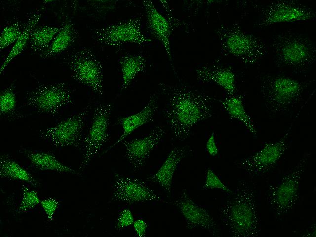 ABI2B / ABI2 Antibody - Immunofluorescence staining of ABI2 in Hela cells. Cells were fixed with 4% PFA, permeabilzed with 0.1% Triton X-100 in PBS, blocked with 10% serum, and incubated with rabbit anti-Human ABI2 polyclonal antibody (dilution ratio 1:1000) at 4°C overnight. Then cells were stained with the Alexa Fluor 488-conjugated Goat Anti-rabbit IgG secondary antibody (green). Positive staining was localized to cytoplasm and nucleus.