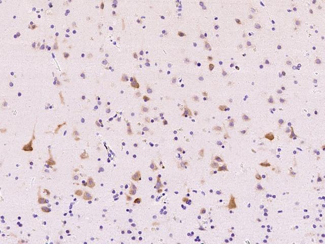 ABI2B / ABI2 Antibody - Immunochemical staining of human ABI2 in human brain with rabbit polyclonal antibody at 1:1000 dilution, formalin-fixed paraffin embedded sections.