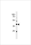 ABI3 Antibody - Mouse Abi3 Antibody western blot of mouse liver tissue lysates (35 ug/lane). The Abi3 antibody detected the Abi3 protein (arrow).